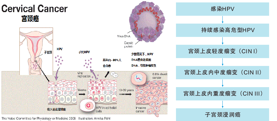 宫颈癌病因明确可防可治